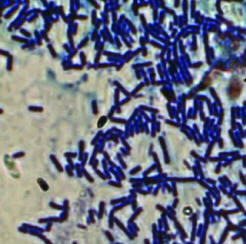 Spore stained Bacillus subtilis (100 x magnification). | Download  Scientific Diagram